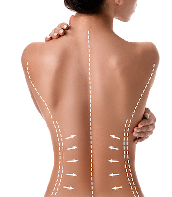 Frau mit Markierungen